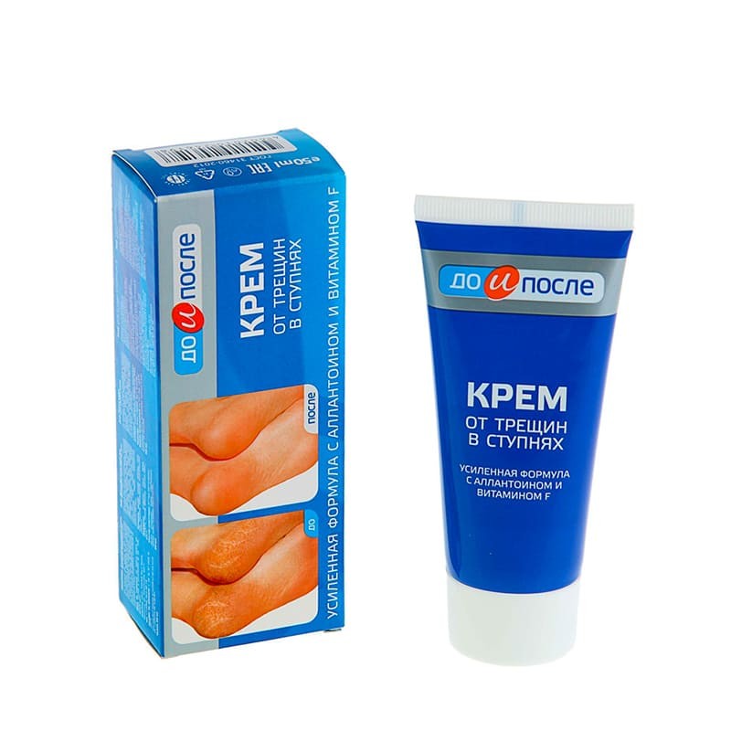 Medicines of local effect, Ointment «Before and after» 150ml, Ռուսաստան